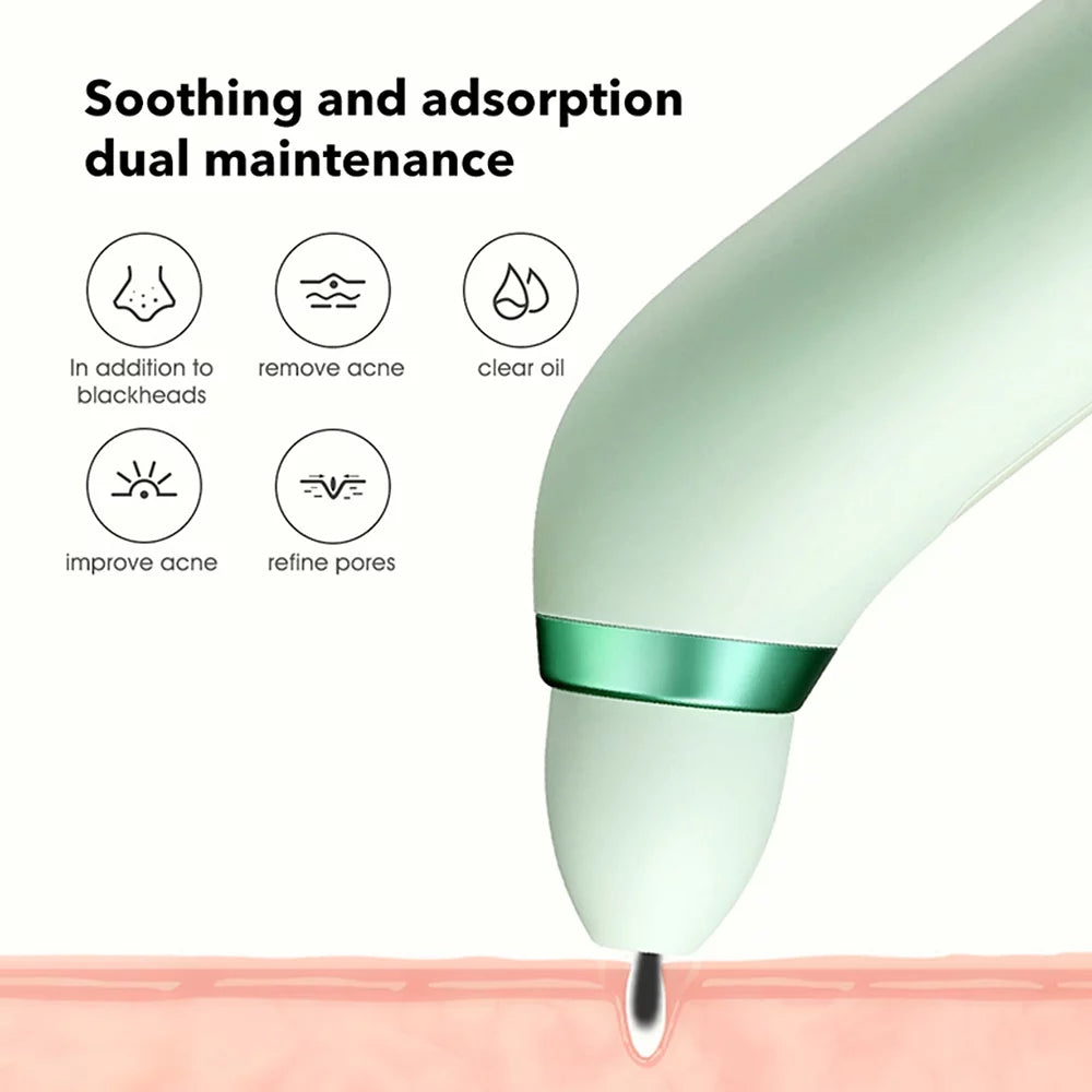 Blackhead Remover with Camera and Suction Probes T52929
