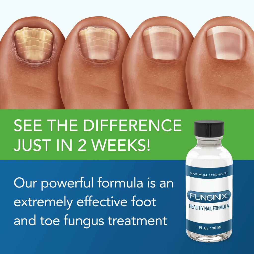 Anti-Fungal Nail Formula 1 fl oz A697